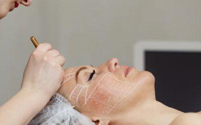 Recovery from PDO Threads in Orlando, FL: How to Care for Your Skin