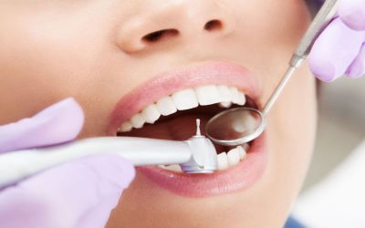 Enhance Your Smile with Professional Care with a Crown Dentist in Chaska, MN